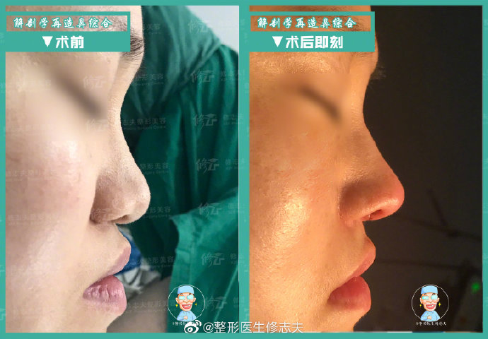 厦门修志夫技术好不好?想找他做鼻子。